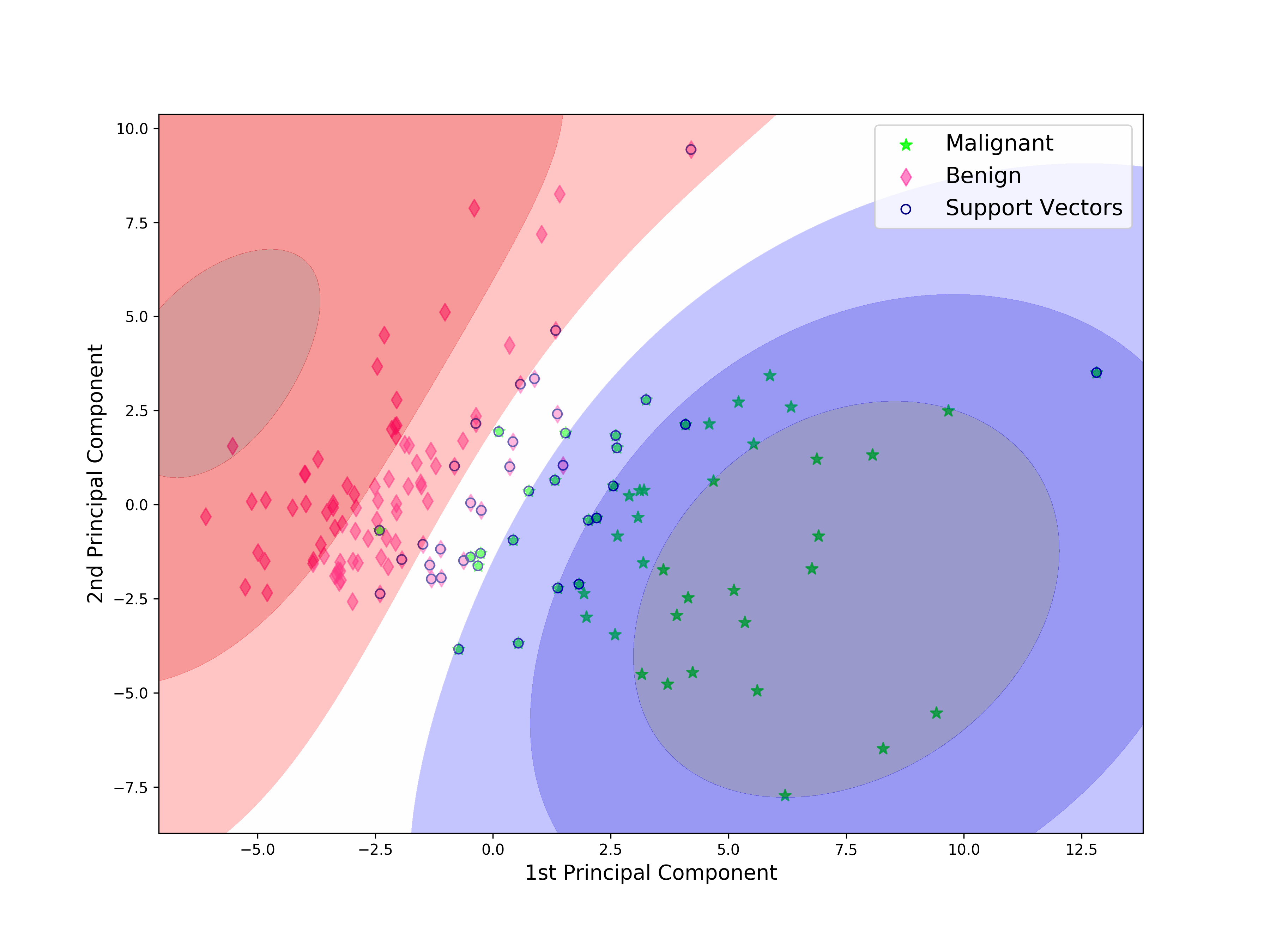 SVM decision boundary over the first two principal components, separating malignant and benign samples with support vectors marked
